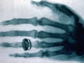 L'imagerie médicale, en savoir plus... L'imagerie médicale, en savoir plus...
